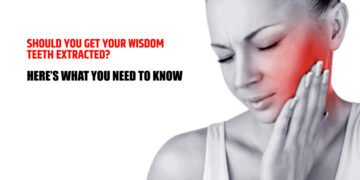 Should You Get Your Wisdom Teeth Extracted? Here’s What You Need to Know